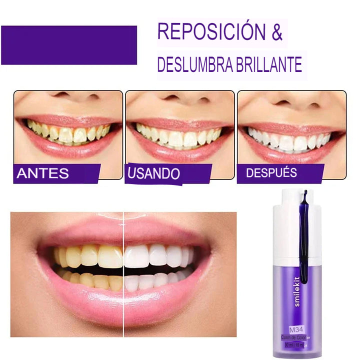 BLANQUEADOR DENTAL V34 ORIGINAL