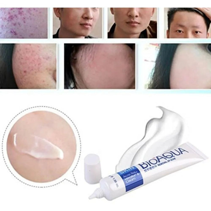 Bioaqua Crema Facial Removedora Acne 30g